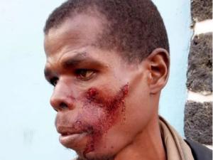 Battered in Uganda, Uzabumwana Succumbs to His Injuries